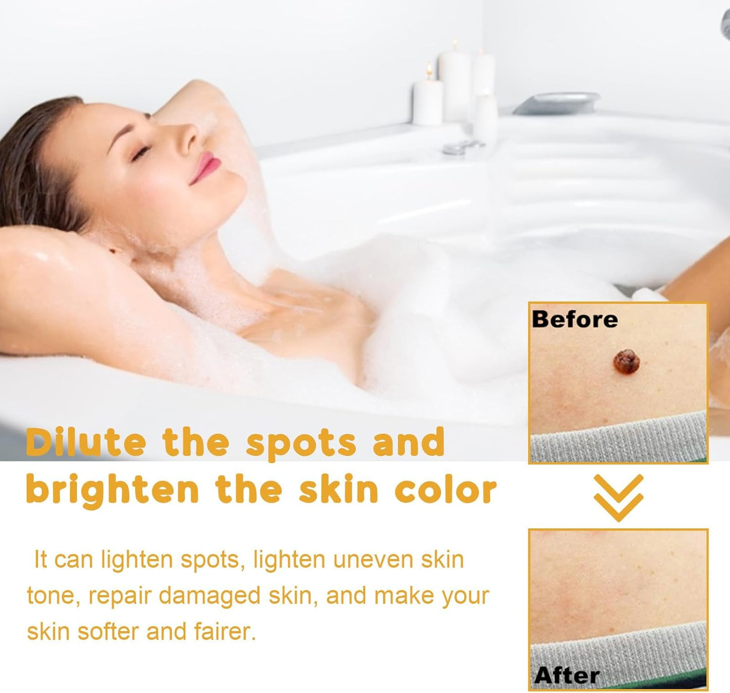 Tag Recede Bee Venom Treatment Spray, Skin Tag Removal Spray with