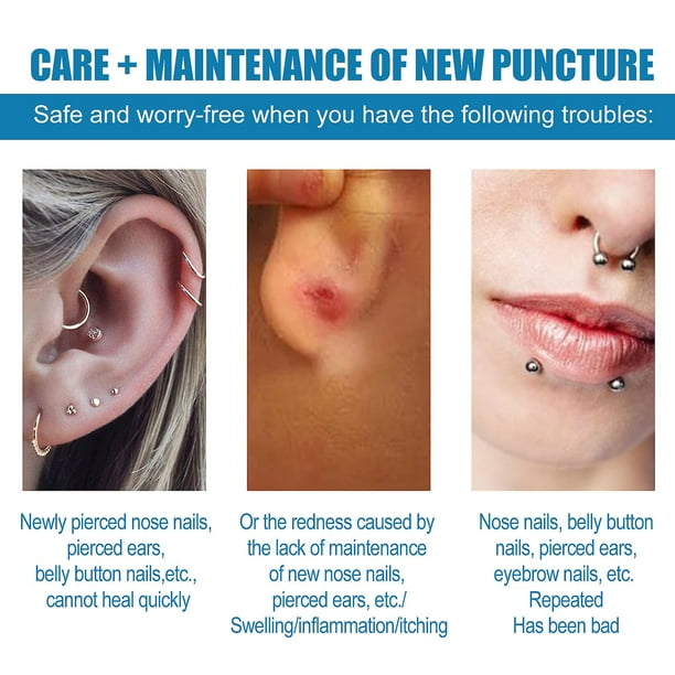 Piercing Bump Relief,heal, Shrink, Remove Keloids & Bumps. Gentle
