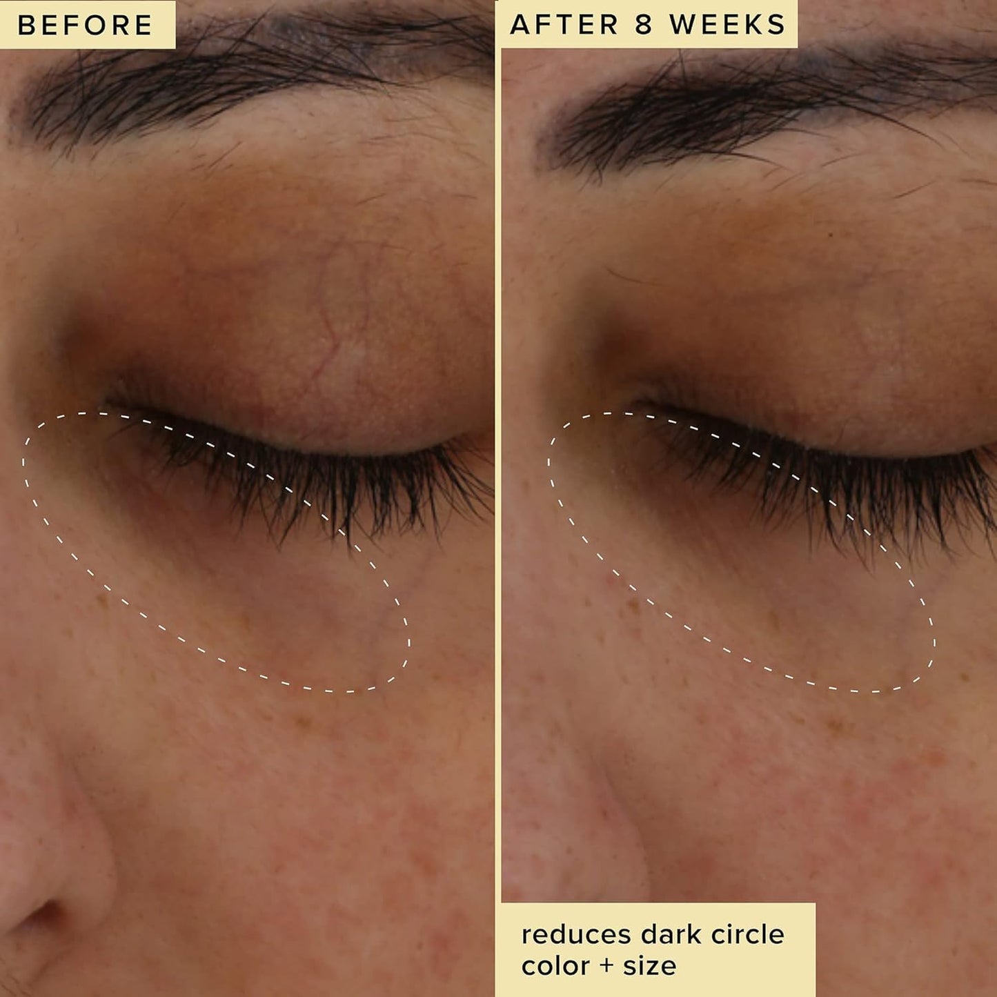Farmacy Brightening Eye Cream - Wake Up Honey Under Eye Cream for Dark Circ