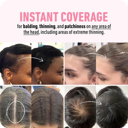 BOLDIFY Hairline Powder - Root Touch Up Hair Color for Gray Coverage - Bald