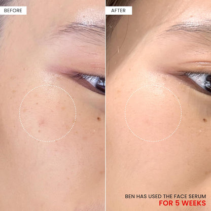 Koji White 2% Kojic Acid Dipalmitate + 3% Tranexamic Acid Serum - Facial Se