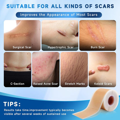Rvlaim Silicone Scar Sheets, Silicone Scar Tape(1.8? x 157? Roll