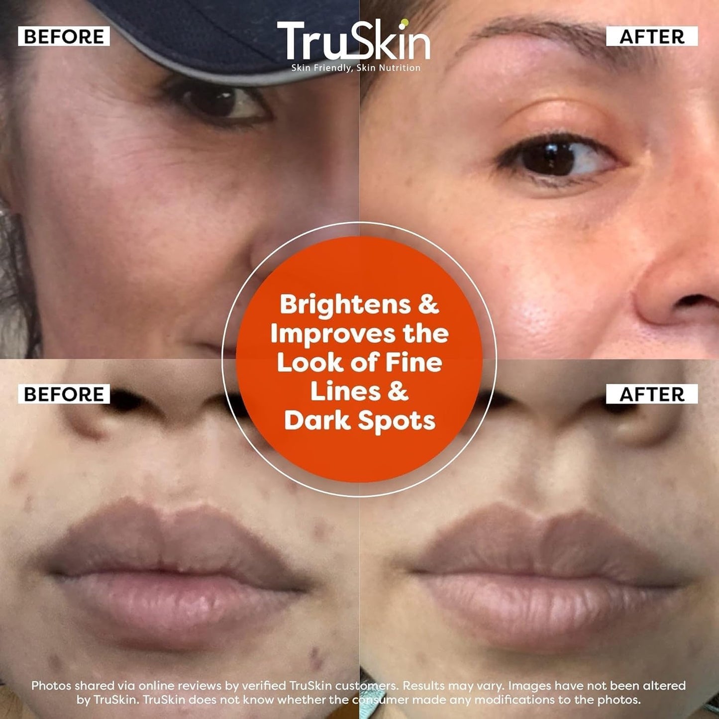 TruSkin Vitamin C Serum For Face – Anti Aging Formula with Vitamin C, Hyalu