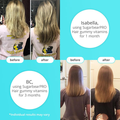 SugarbearPRO Hair Vitamin Longer-Looking Hair Gummy for Women & Men, Extra