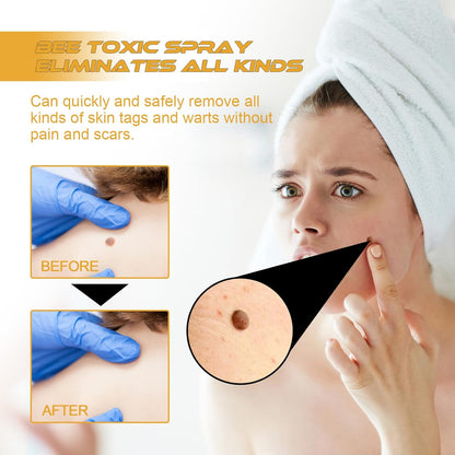 Tag Recede Bee Venom Treatment Spray, Skin Tag Removal Spray with