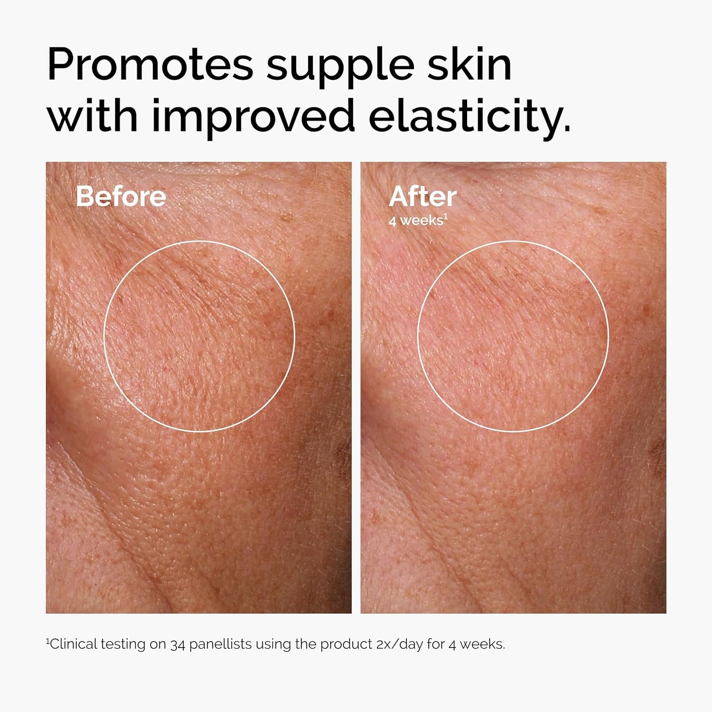 The Ordinary Hyaluronic Acid 2% + B5 (Original Formulation), 30ml